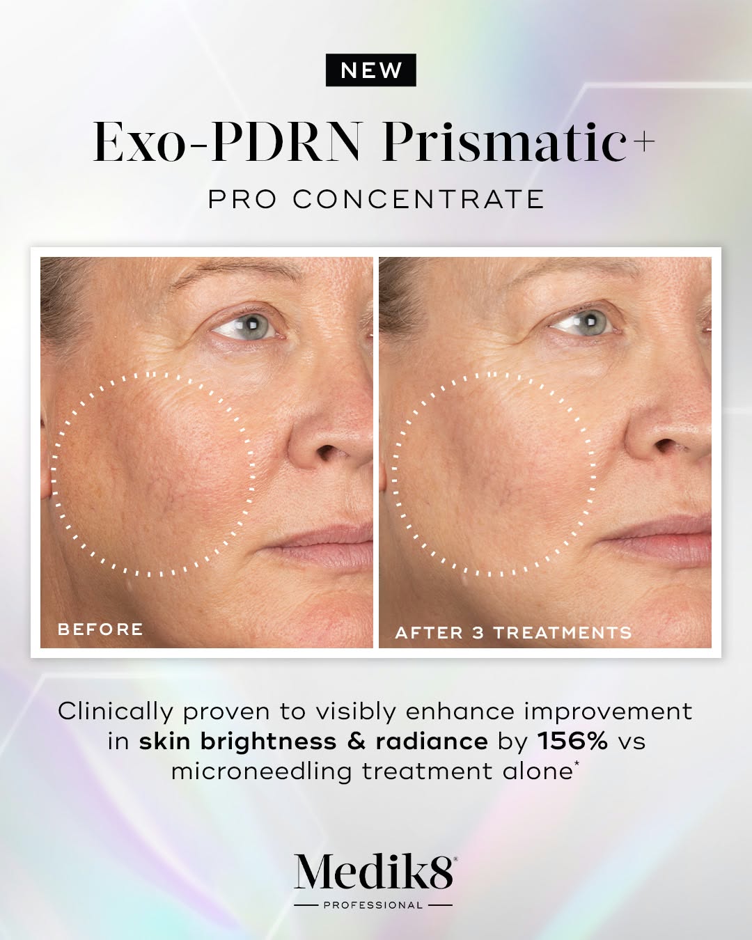 Clinical results: 156% enhancement in skin brightness and radiance